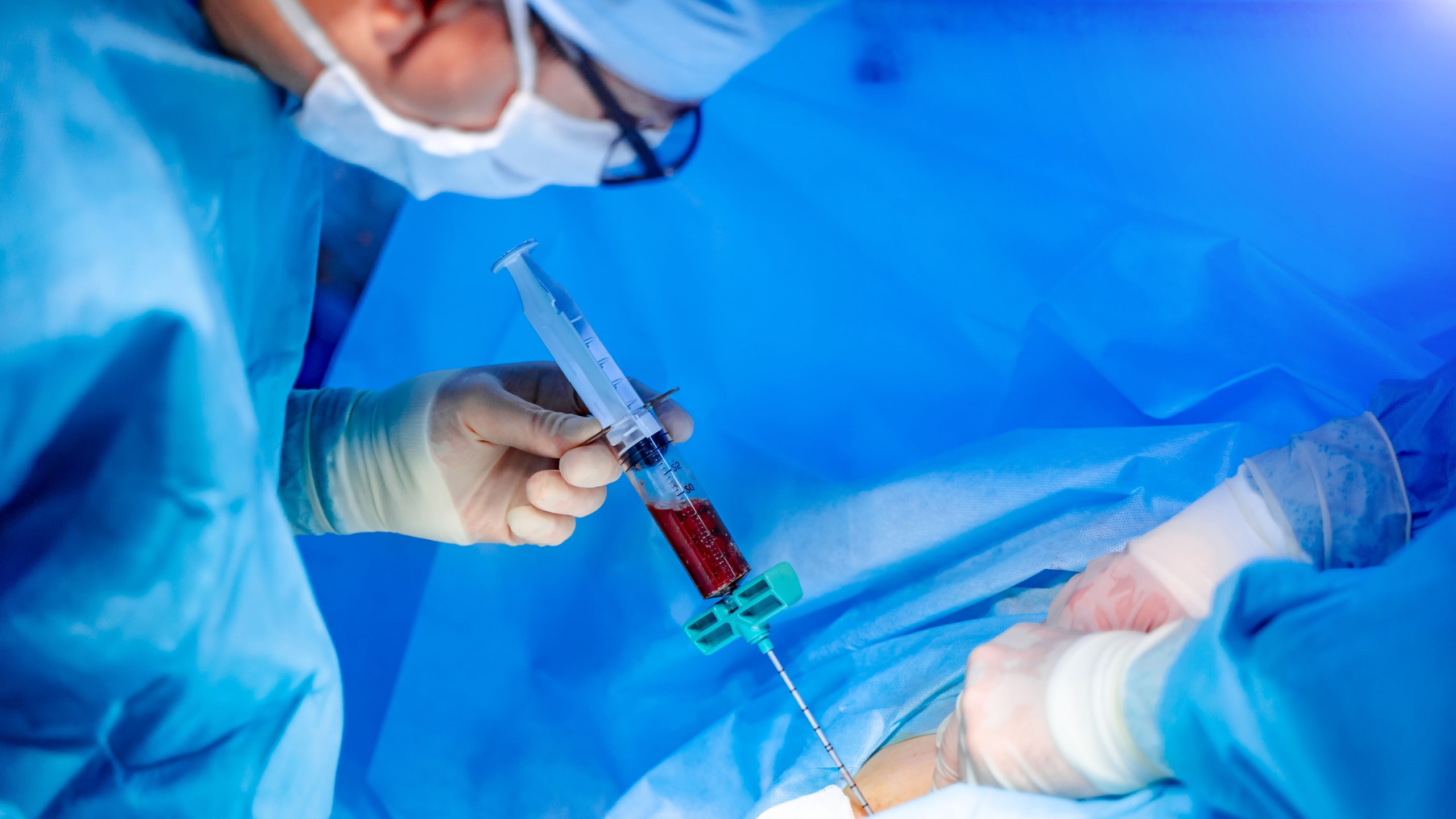 Bone marrow transplant operation. Surgeons in medical uniform and masks working in the operating room.